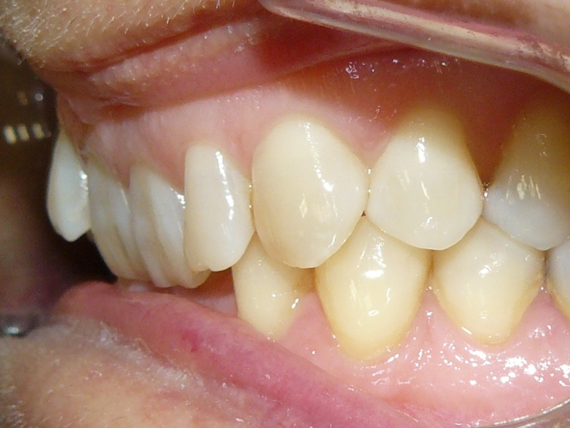 Before image