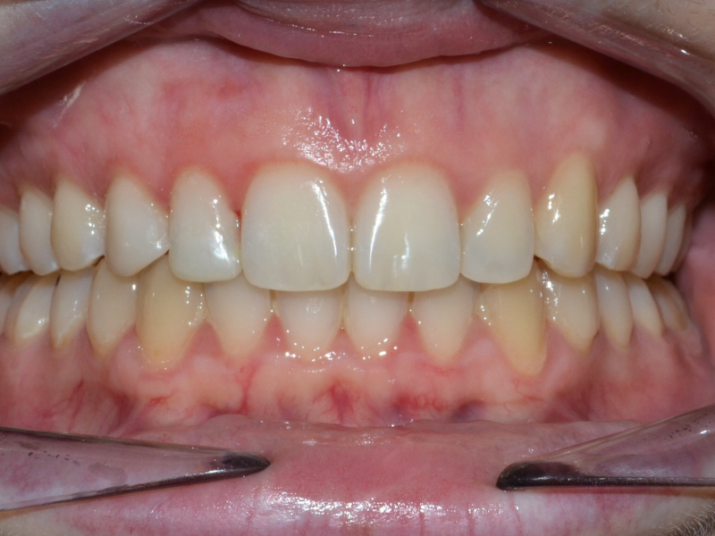 After image