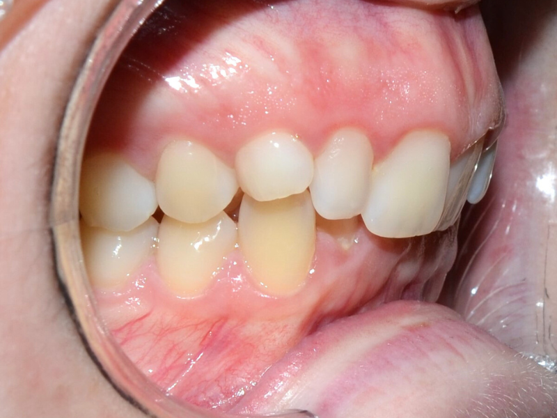 Before image