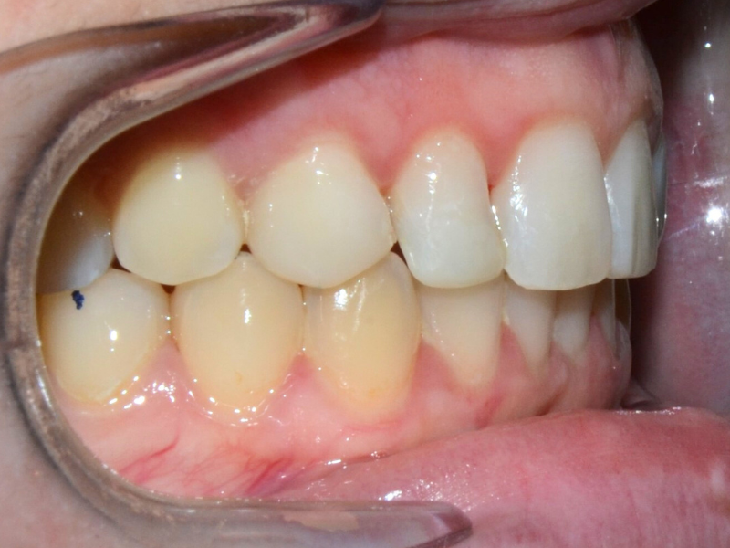 After image